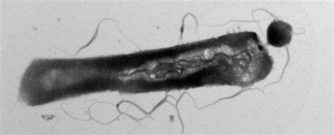  Xenosporidium! En förvånande parasit som förändrar sitt värdars beteende