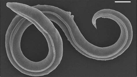  Nematodae: En levande, wrigglande matta som täcker havsbottnen!